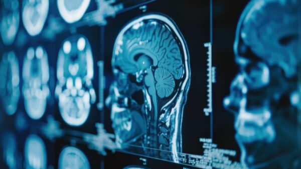 Male sex hormones drive aggressive childhood brain tumour, study finds